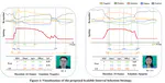 Boosting Micro-Expression Analysis via Prior-Guided Video-Level Regression